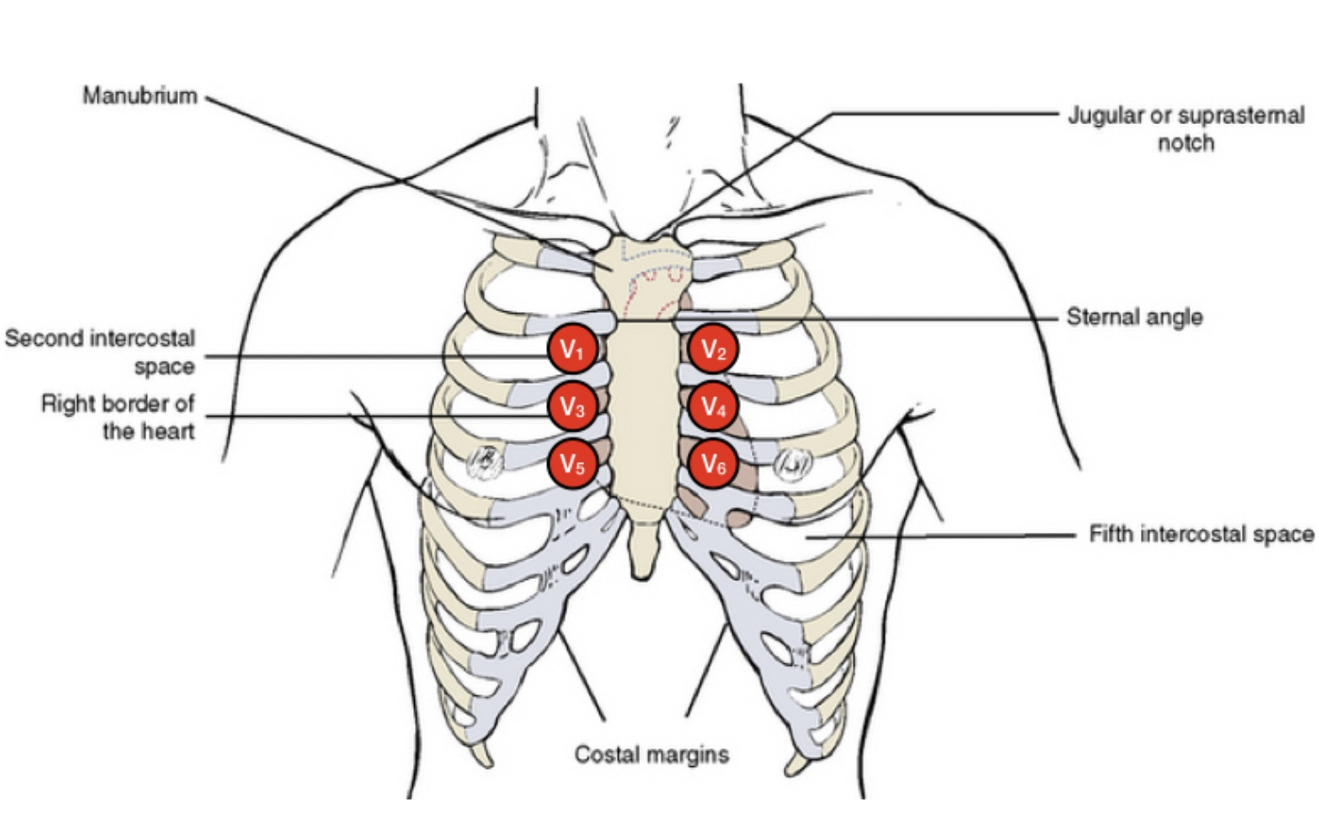 Image showing the ECG positioning for a Brugada ECG
